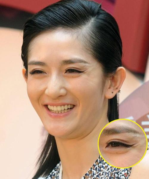 因为爱笑眼角皱纹比较多怎么办,爱笑的女孩有笑纹怎么办