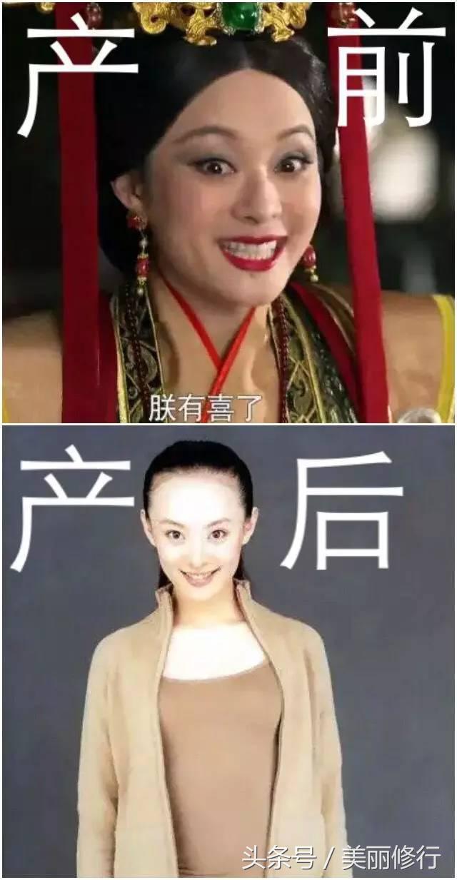 掉头发严重防脱洗发水有用吗,掉头发用防脱的洗发水有效果吗