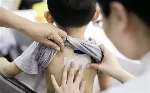 冬病夏治的小妙方,冬病夏治绝佳时机