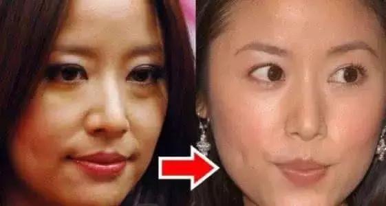 宋祖儿开包眼霜,宋祖儿法国希思黎眼霜