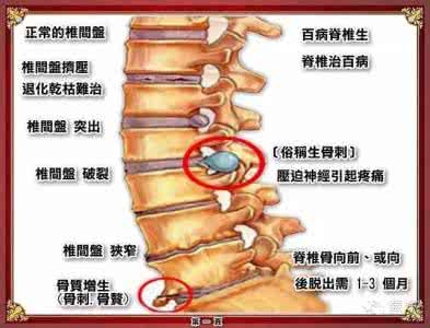 腰椎病骨质增生正骨手法,腰椎骨质增生怎么按摩治疗比较好