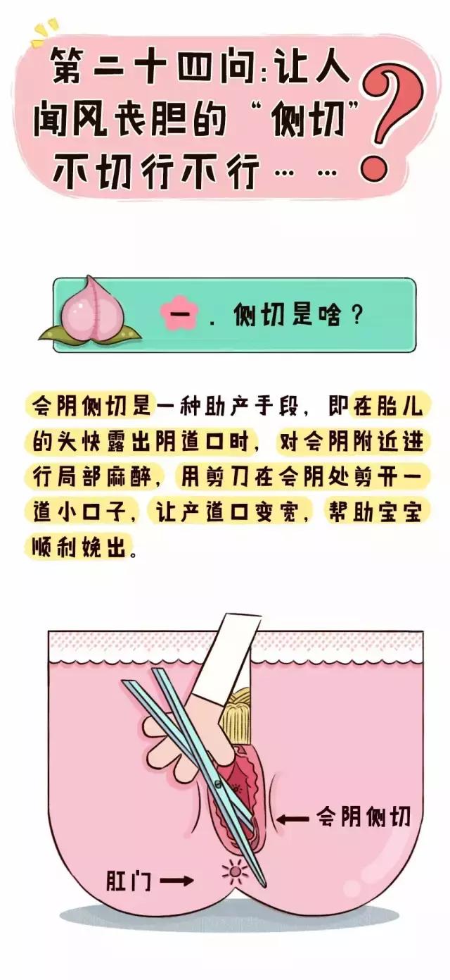 顺产也要挨一刀是真的吗,顺产可不可以不侧切