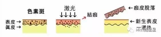 iluminage激光美容仪有哪些功效,紧致去皱美白美容仪