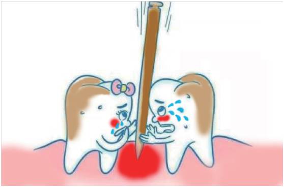 小心“牙”——来自华西口腔医院专家的权威解答