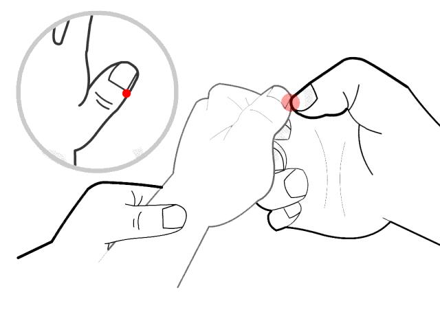 儿童扁桃体肥大切除手术后发烧,发烧引起扁桃体肿大要切除吗