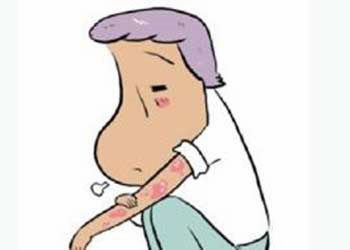 牛皮癣皮损痒是加重了还是减轻了,牛皮癣加重怎么回事