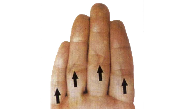 头上爆出青筋是什么原因,头上有青筋暴起怎么处理