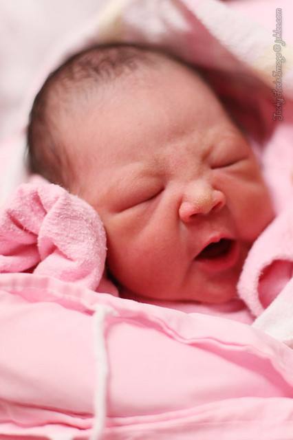 妊娠高血压生宝宝的孕妈,妊娠高血压剖腹产容易大出血吗