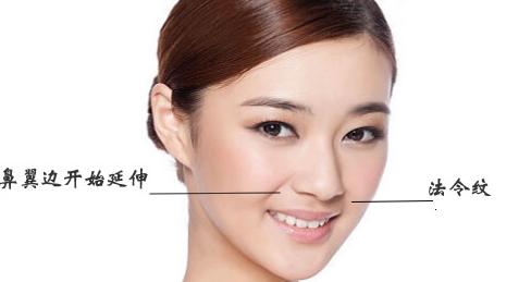 预防法令纹的方法,预防法令纹医美