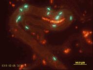 精子的发展历程,精子科学术语怎么说
