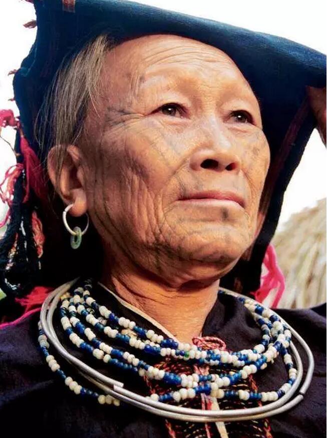 你真的了解疤痕疙瘩吗,真实存在的纹身