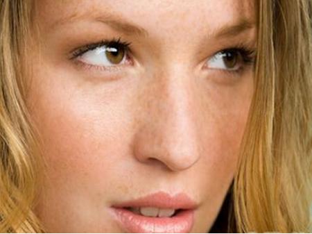 孕期如何避免长蝴蝶斑,孕期蝴蝶斑多久能消失