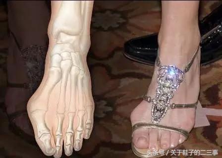 穿高跟鞋怎么保护脚趾头,高跟鞋防磨脚趾头方法