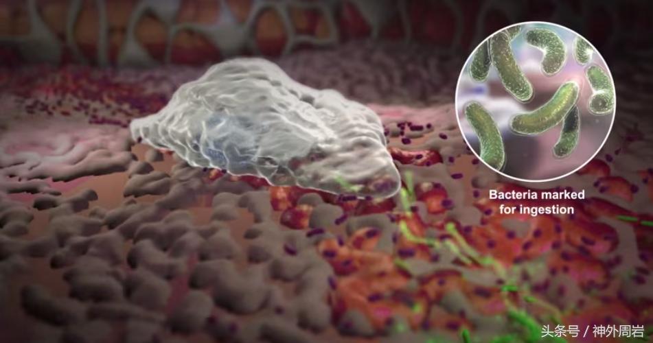 为什么急性炎症会引起白细胞增高?有一个特异指标直指细菌感染