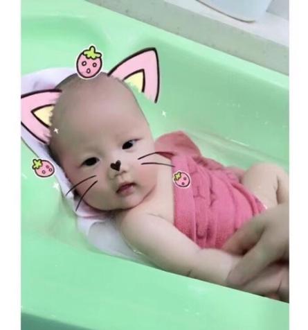 开指时候疼得受不了怎么办,开指疼多久