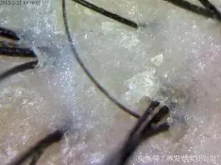 头发少适合什么发型,头发少怎么扎好看