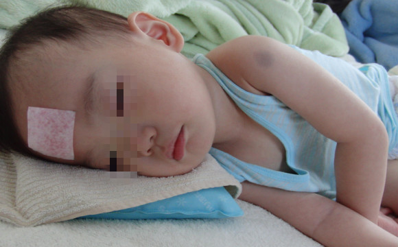 感冒发烧引起小儿癫痫发作怎么办,小孩发烧导致癫痫是先天还是后天