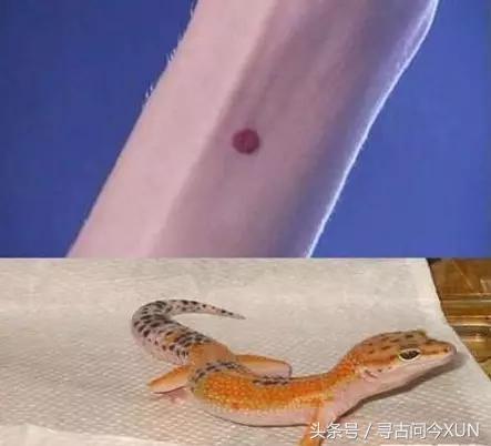 守宫砂的朱砂痣,朱砂痣跟守宫砂