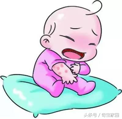 宝宝热疹治疗方法,宝宝热疹反复发作如何除根