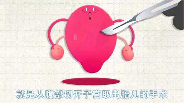 ［视频］选择顺产or剖腹产？并不是你以为的那么简单...