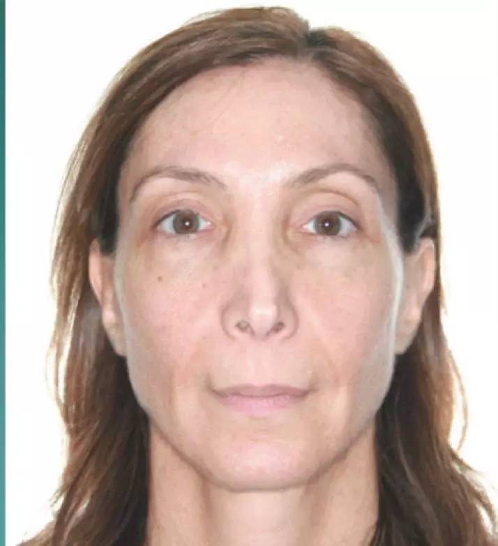 医生郭涛,正畸郭涛