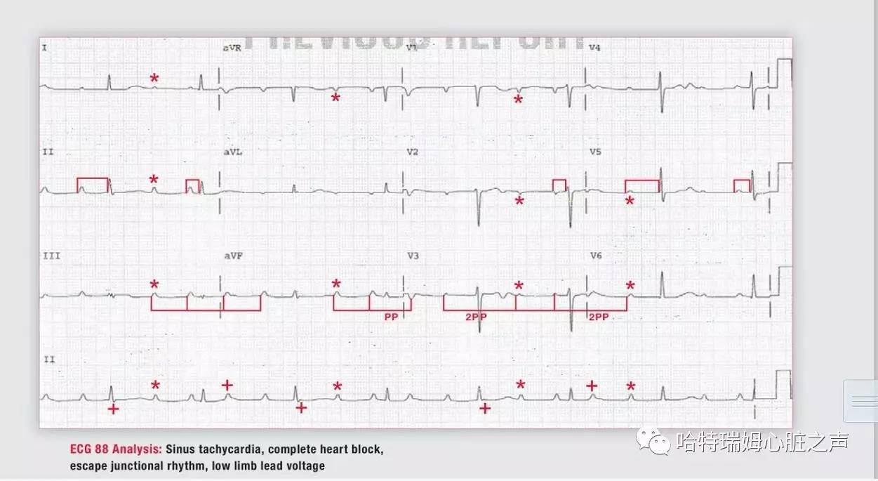 读心有术100期,读心有术视频讲解