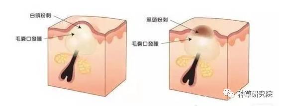 怎么让皮肤光滑如蛋清,怎样能让皮肤变得和鸡蛋一样光滑