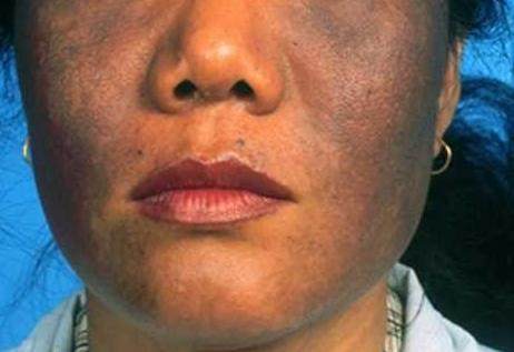 洗面奶为什么变黑了,洗面奶变黑揭秘