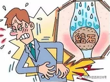 “尿石总攻”是个什么“攻”?