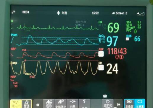 「护理宣教」小小穿刺针，实时报血压