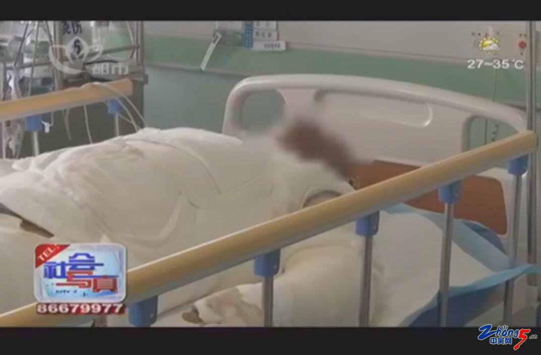 突发爆燃受伤重度烧伤,遭受意外事件受伤治疗要钱吗