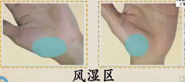 手上发红发紫是怎么回事,手部发青要警惕