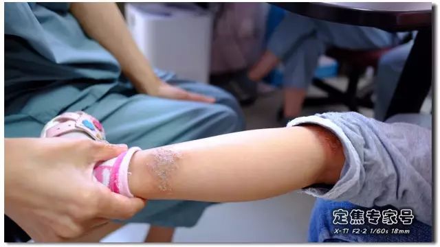 「热点」越是古老的疾病坑越多，一个湿疹能有多少坑把父母掉进去？