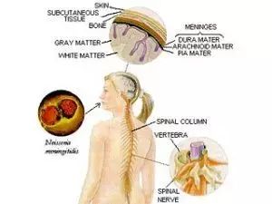 有肺结核吃什么补品,肺结核吃什么补药