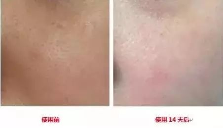 压力山大的时候要如何调整皮肤状态？