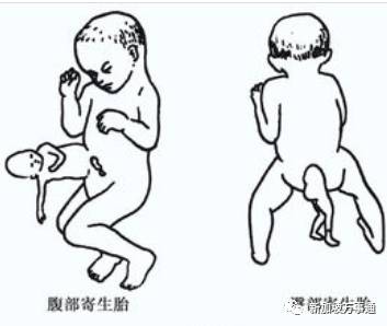 <html>
<head><title>502BadGateway</title></head>
<body>
<center><h1>502BadGateway</h1></center>
<hr><center>nginx</center>
</body>
</html>
<!--apaddingtodisableMSIEandChromefriendlyerrorpage-->
<!--apaddingtodisableMSIEandChromefriendlyerrorpage-->
<!--apaddingtodisableMSIEandChromefriendlyerrorpage-->
<!--apaddingtodisableMSIEandChromefriendlyerrorpage-->
<!--apaddingtodisableMSIEandChromefriendlyerrorpage-->
<!--apaddingtodisableMSIEandChromefriendlyerrorpage-->
