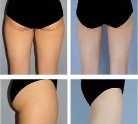 「杏林微科普」您的“尊臀”还好吗？