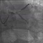 典型病例及处理方法,典型病例分析及治疗方法