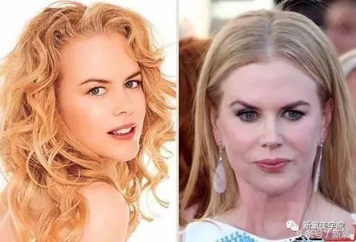 小s脸肿原因,小s脸怎么越来越肿