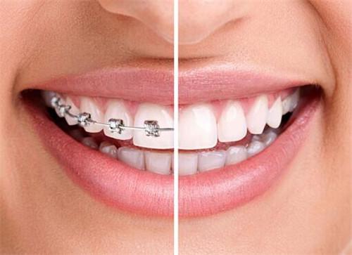 如果长智齿了怎么办,如果长了智齿怎么办