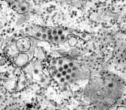 狂犬病毒vs埃博拉病毒,埃博拉病毒和狂犬病毒哪个更厉害