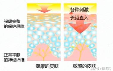 敏感肌更要清洁皮肤,敏感肌做什么护肤项目