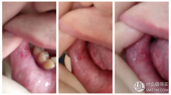 家庭医护小药箱,家庭用的医疗急救药箱