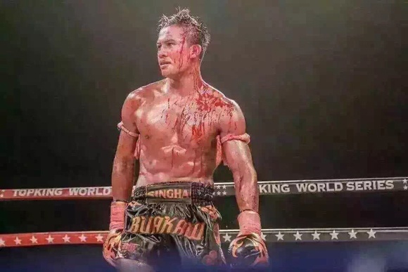 恩波格斗孤儿感人对话,恩波格斗孤儿被带走的视频