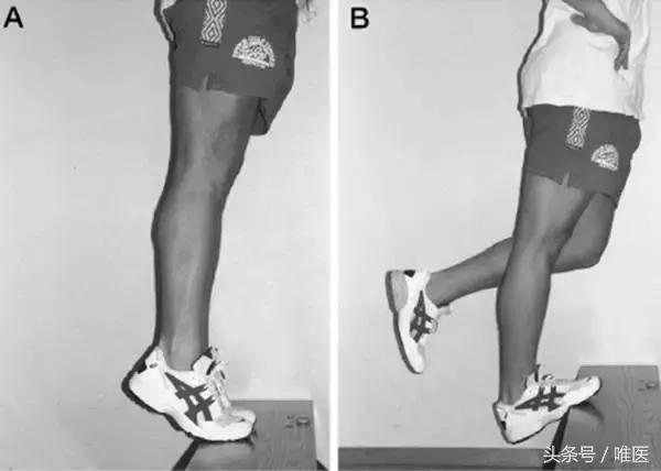 跟腱炎是不是要放弃运动了,得跟腱炎就是废了吗