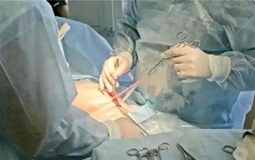 孕妇怀孕饭量大的视频,孕妇怀孕3个多月饭量不大