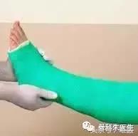 踝关节骨折没有手术怎么办,骨折保守治疗可以活动踝关节吗