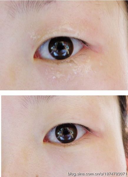 夜谈奔三女眼部千日养护记