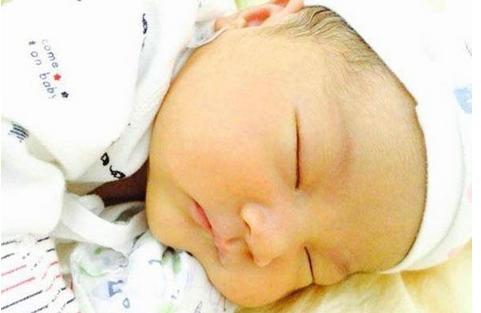 出生9天的宝宝黄疸,新生儿10多天才出现黄疸