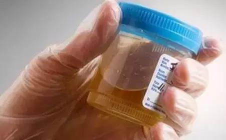 肥胖引起的血糖高怎么快速降下来,肥胖患者降血糖应该怎么做